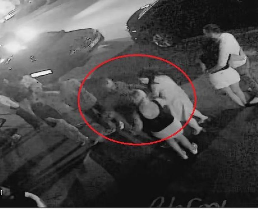 Kafa attı vücudunda sigara söndürdü! Eski sevgili dehşeti kan dondurdu