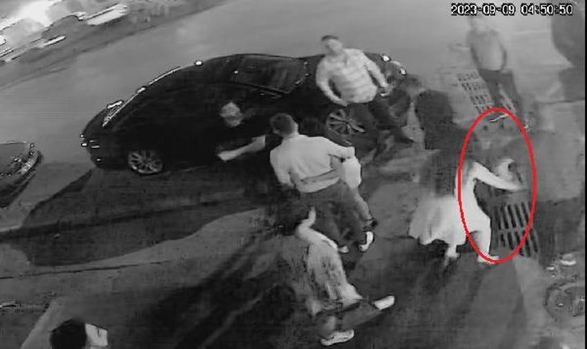 Kafa attı vücudunda sigara söndürdü! Eski sevgili dehşeti kan dondurdu