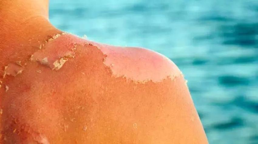 Karbonatlı su nasıl şifa dağıtır? Alışkanlık haline getirin: Her gece 1 bardak vücuda reset atıyor! Kötü kokuya karşı deodorant görevi görüyor