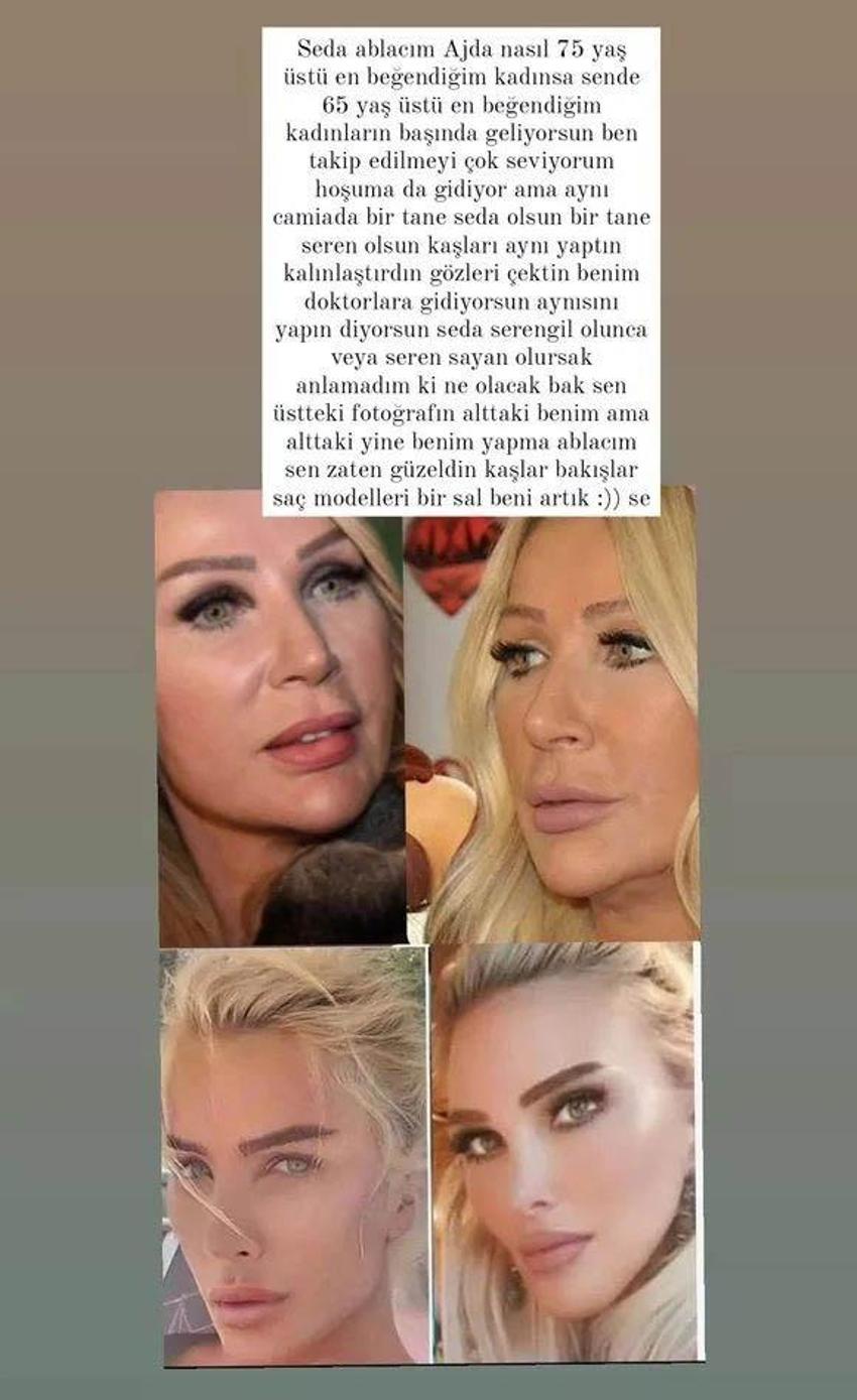 Seren Serengil’den Sayan’a fotoğraflı taklit suçlaması! ‘Benim doktorlara gidiyorsun’