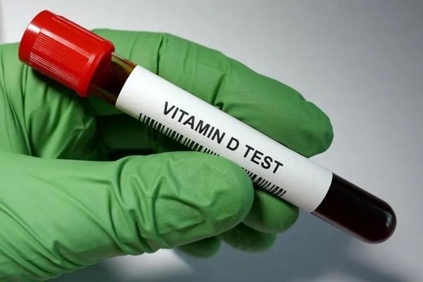 Bu vitamin yüzde 87 daha güçlü: Kemikleri çelik gibi yapıyor! Uzmanlar günde 10 μg/400 IU kolekalsiferol tavsiye ediyor!