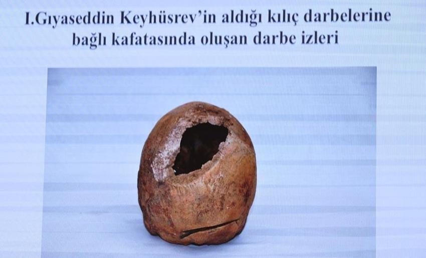 Selçuklu sultanlarının kemiklerinin DNA analizleri yapıldı! Hastalıkları ve ölüm nedenleri ortaya çıktı