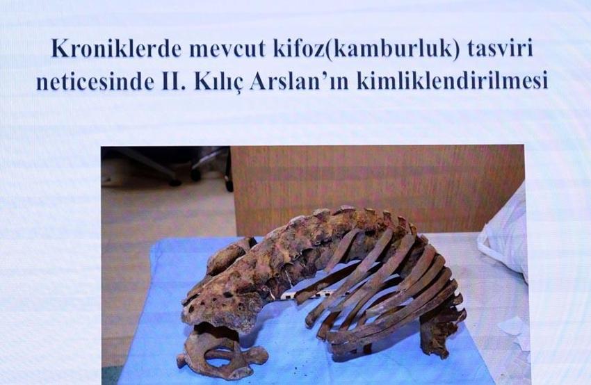 Selçuklu sultanlarının kemiklerinin DNA analizleri yapıldı! Hastalıkları ve ölüm nedenleri ortaya çıktı