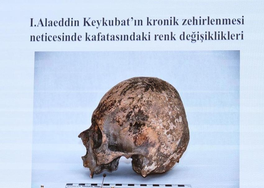Selçuklu sultanlarının kemiklerinin DNA analizleri yapıldı! Hastalıkları ve ölüm nedenleri ortaya çıktı