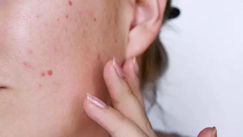Ev yapımı hassas cilt maskesi: Sadece 3 malzemeyle ışıl ışıl parlatıyor!