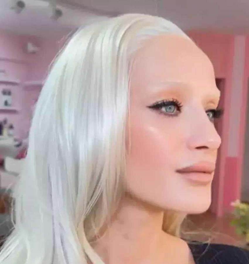 Didem Soydan'dan 'estetik' cevabı! “Yüz gerdirilmiş ama ispatlayamam"