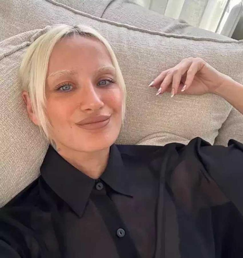  Didem Soydan'dan 'estetik' cevabı! “Yüz gerdirilmiş ama ispatlayamam"