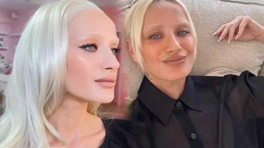  Didem Soydan'dan 'estetik' cevabı! “Yüz gerdirilmiş ama ispatlayamam"