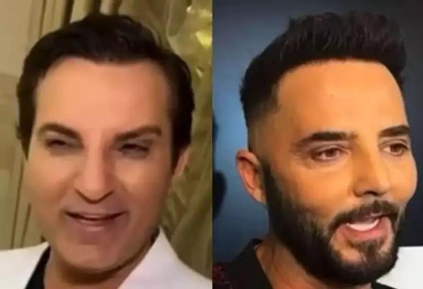 Gökhan Türkmen: Estetik yaptırıp bir de inkar ediyorlar!