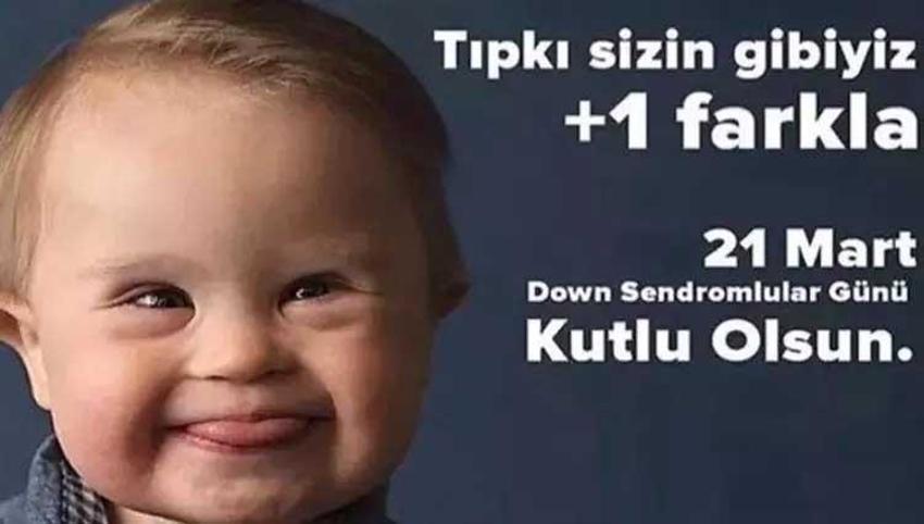 Down Sendromu Günü sözleri || Anlamlı Down Sendromu farkındalık günü ile ilgili sözler: 21 Mart Down Sendromu Farkındalık günü mesajları