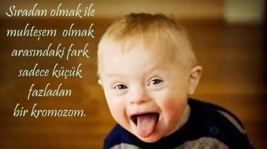 Down Sendromu Günü sözleri || Anlamlı Down Sendromu farkındalık günü ile ilgili sözler: 21 Mart Down Sendromu Farkındalık günü mesajları
