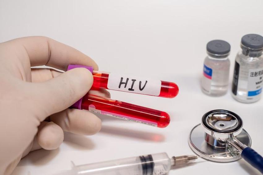 AIDS belirtileri (Erkek Kadın) AİDS hastalığı nedir, AİDS nasıl bulaşır, öldürür mü, AİDS hastalığı kan tahlili sonucunda anlaşılır mı, geçer mi, tedavisi var mı?