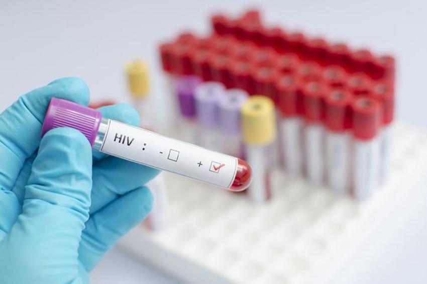 AIDS belirtileri (Erkek Kadın) AİDS hastalığı nedir, AİDS nasıl bulaşır, öldürür mü, AİDS hastalığı kan tahlili sonucunda anlaşılır mı, geçer mi, tedavisi var mı?