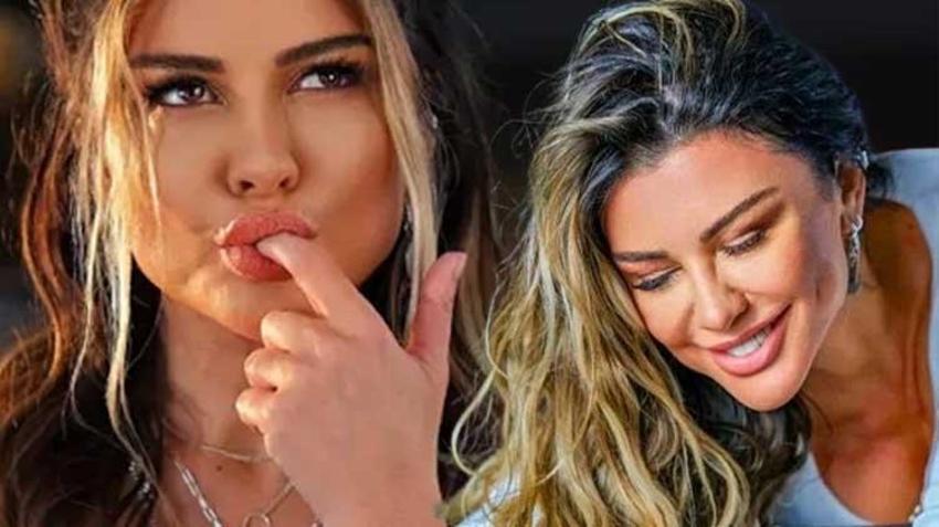 Anne sütü, sünnet derisi yetmedi, yüzünü gerdirdi! Selen Görgüzel bandajlı halini paylaştı