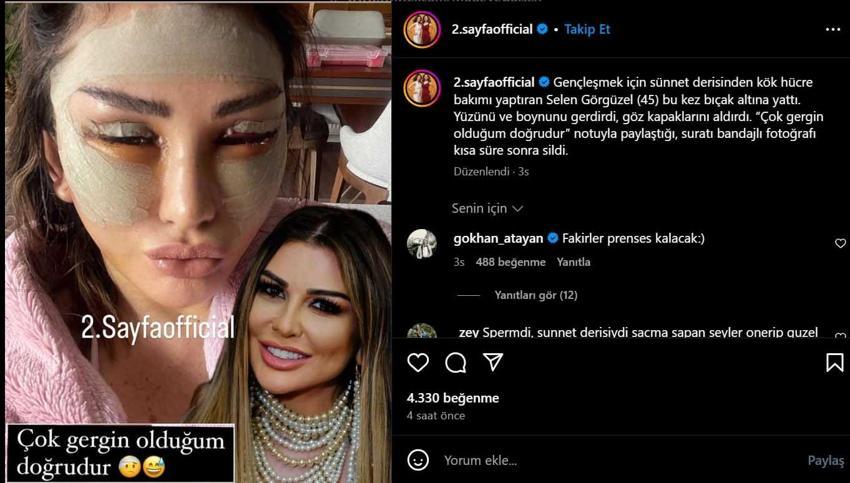 Anne sütü, sünnet derisi yetmedi, yüzünü gerdirdi! Selen Görgüzel bandajlı halini paylaştı