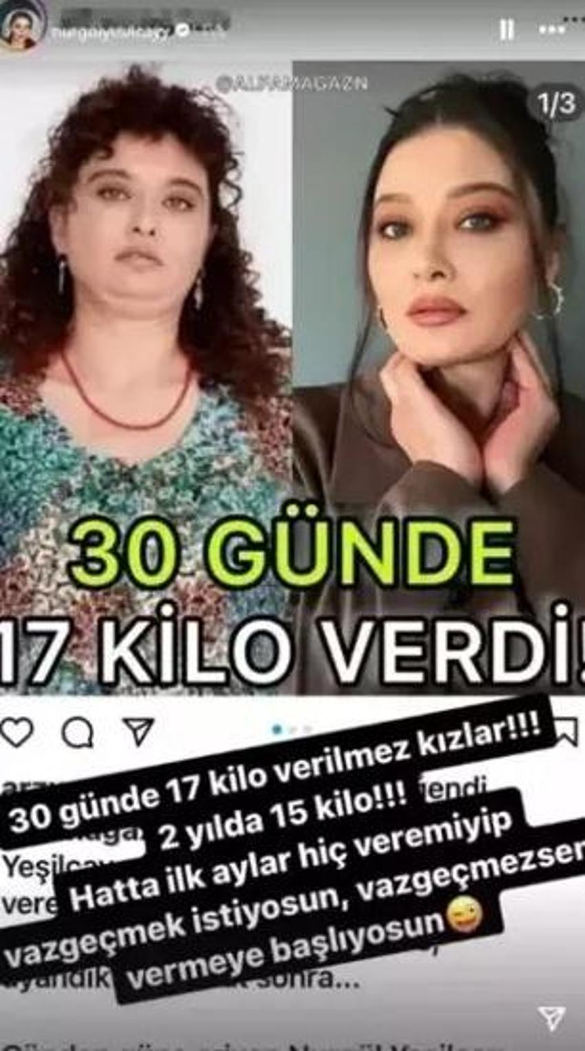 Nurgül Yeşilçay'dan kilo verme tüyosu: Gözaltı torbası için yumurta akı, selülitlerim için filtre kahve...