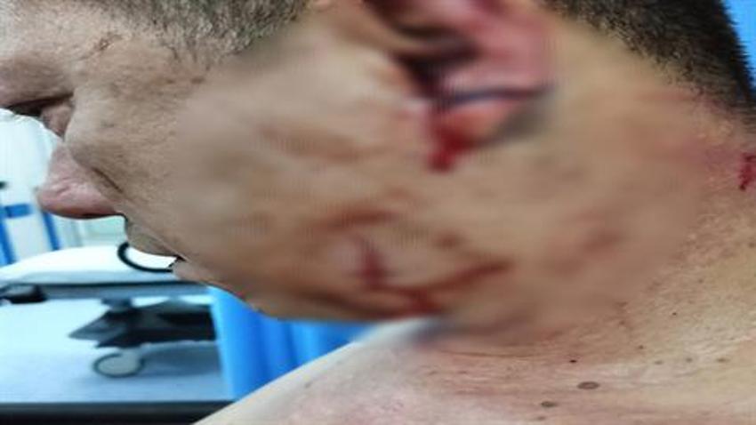 O köpekler sahipli çıktı! Oğlunu korumak isterken çenesi kırılmıştı