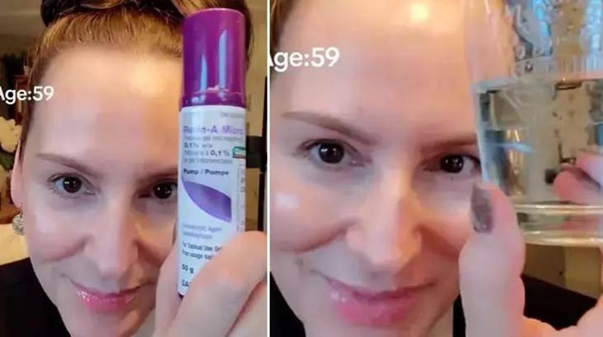 59 yaşında ama tek bir kırışığı yok! Botoks yok, dolgu yok: Meğer gençlik sırrı buymuş!