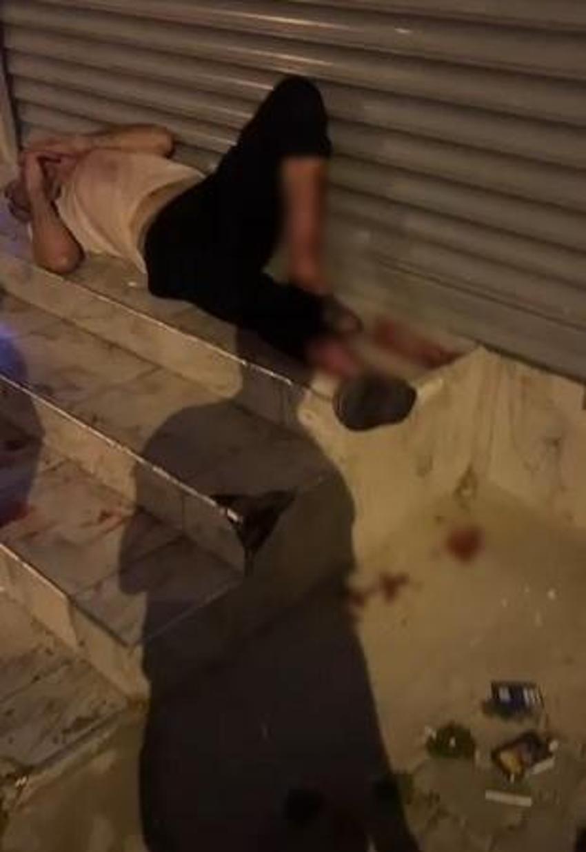 Adana'da evden kaçan pitbull dehşeti: İki kişiyi yaraladı