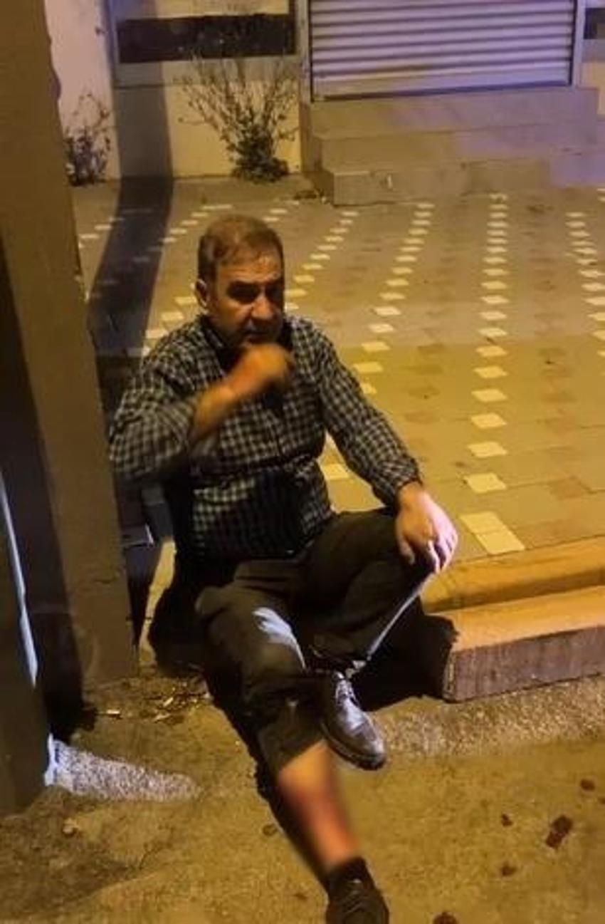 Adana'da evden kaçan pitbull dehşeti: İki kişiyi yaraladı
