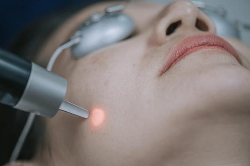 Kanser habercisi olabilir! Lazer uygulaması yaptırırken bu detaya dikkat