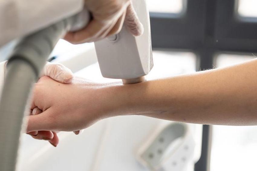 Kanser habercisi olabilir! Lazer uygulaması yaptırırken bu detaya dikkat