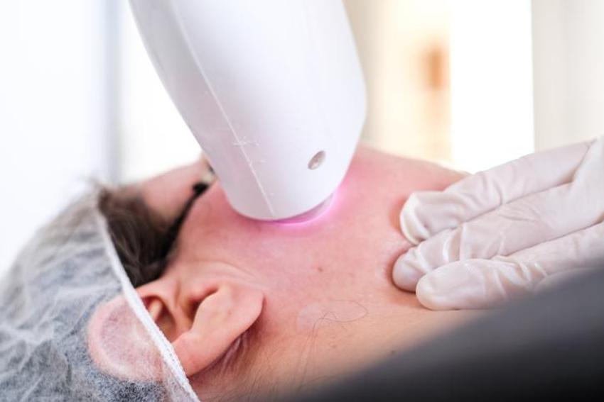 Kanser habercisi olabilir! Lazer uygulaması yaptırırken bu detaya dikkat