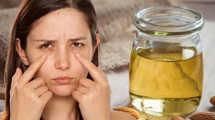 Doğduğundan beri göz altı morlukları vardı; çareyi o yağda buldu: "Tek bir morluk bırakmadı"