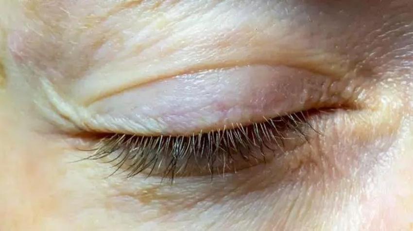 Doğduğundan beri göz altı morlukları vardı; çareyi o yağda buldu: "Tek bir morluk bırakmadı"