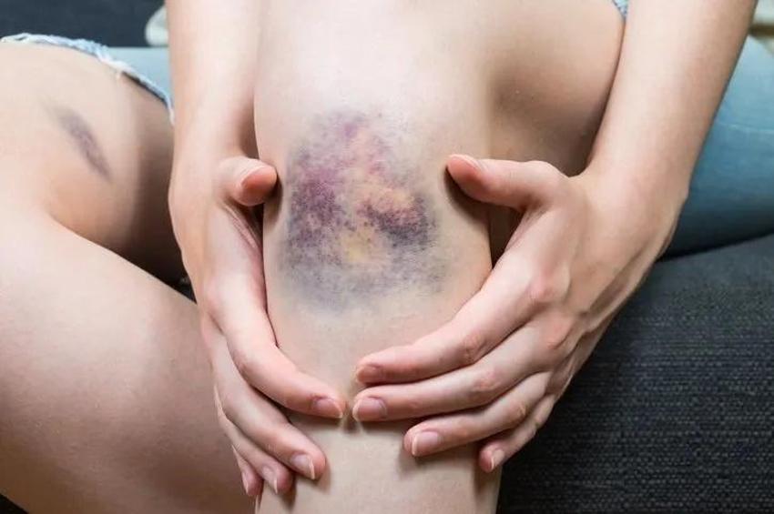 Kanserin ilk belirtisi dizlerde kendini gösteriyor: Eğer dizinizde bu hareket varsa...