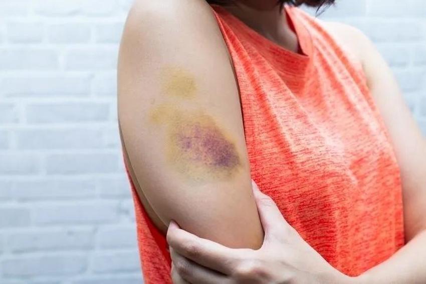 Kanserin ilk belirtisi dizlerde kendini gösteriyor: Eğer dizinizde bu hareket varsa...