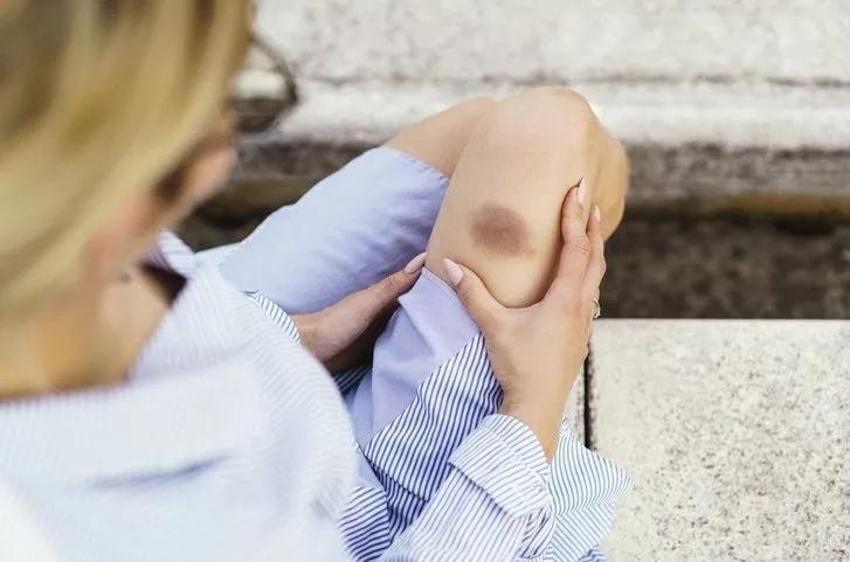 Kanserin ilk belirtisi dizlerde kendini gösteriyor: Eğer dizinizde bu hareket varsa...