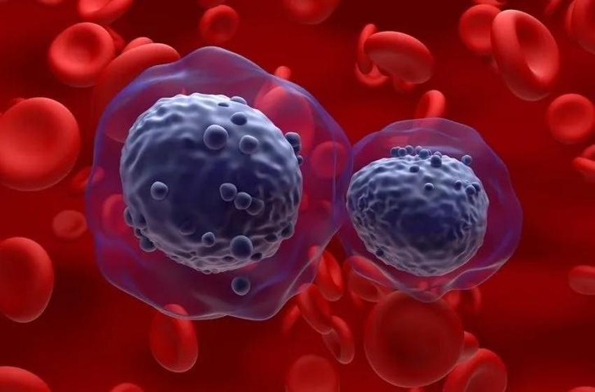Kanserin ilk belirtisi dizlerde kendini gösteriyor: Eğer dizinizde bu hareket varsa...
