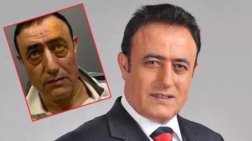 Mahmut Tuncer estetik yaptırdı! ‘Mahmut El Roman’
