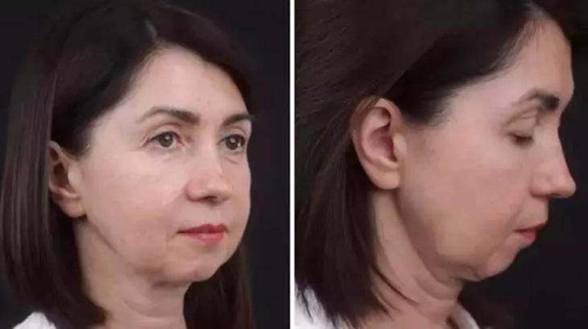 50 yaşındaki kadının inanılmaz değişimi! Gören 20 yaşında sanıyor