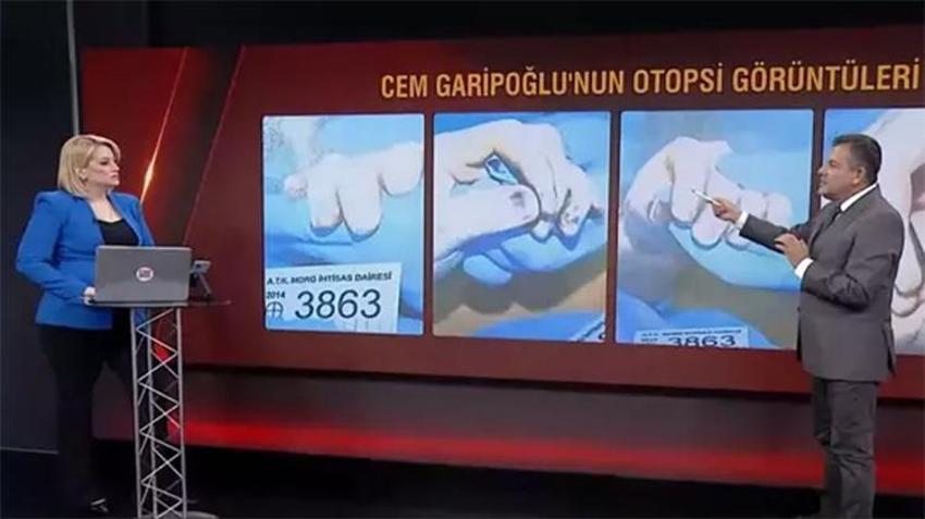 Cem Garipoğlu'nun otopsi görüntülerindeki morlukların sebebi belli oldu