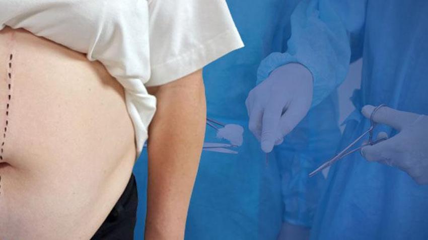Obez hastalarda da uygulanabiliyor! Uzmanı açıkladı: Haftalarca beklemeye gerek yok