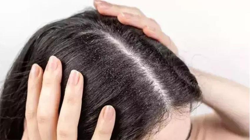 Saçlarınızı yanlış yıkıyor olabilirsiniz? Uzmanı saç tipine göre haftalık çizelge verdi