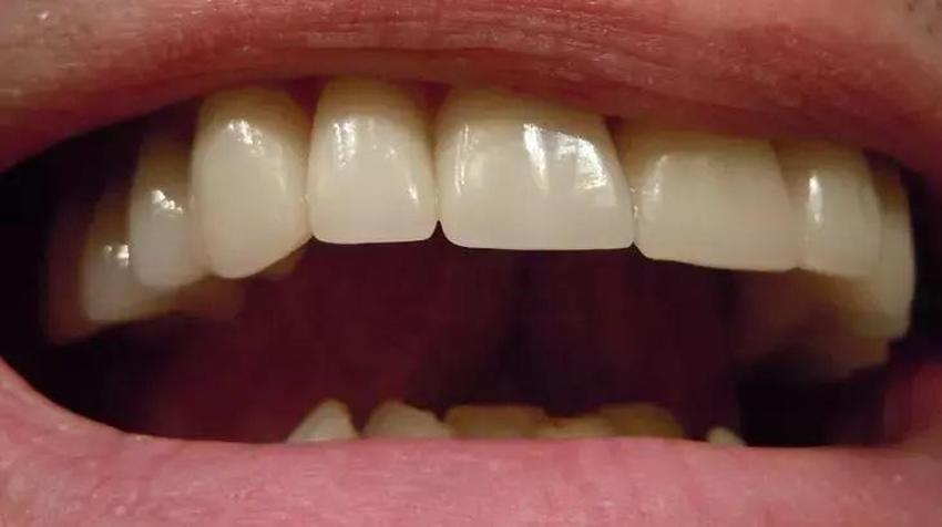 1 çorba kaşığı kadar ağızda çalkalayın! Ağız kokusu da nedeni de ortadan kalkıyor