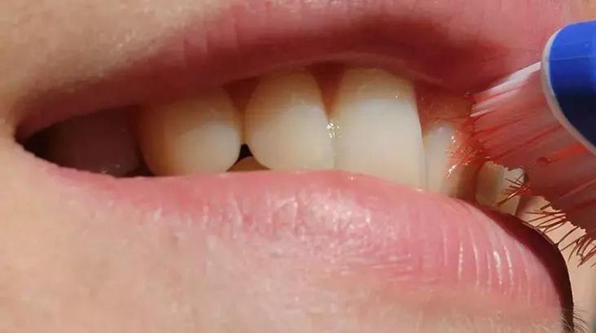 1 çorba kaşığı kadar ağızda çalkalayın! Ağız kokusu da nedeni de ortadan kalkıyor