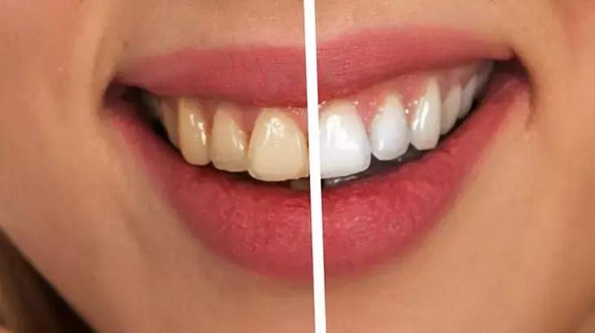 1 çorba kaşığı kadar ağızda çalkalayın! Ağız kokusu da nedeni de ortadan kalkıyor