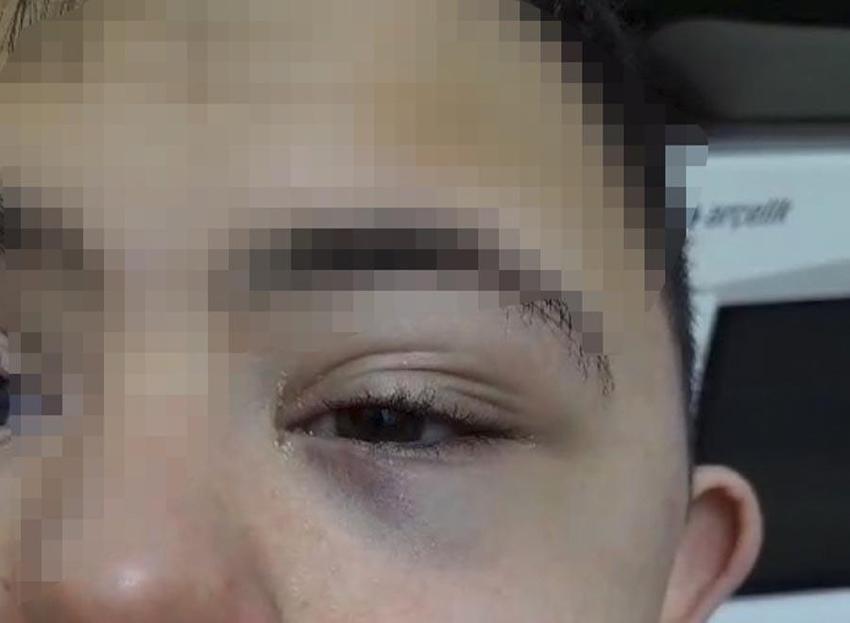 Down sendromlu öğrenciye şiddet güvenlik kameralarına yansıdı! Görüntüler izleyenleri şok etti öğretmen tutuklandı