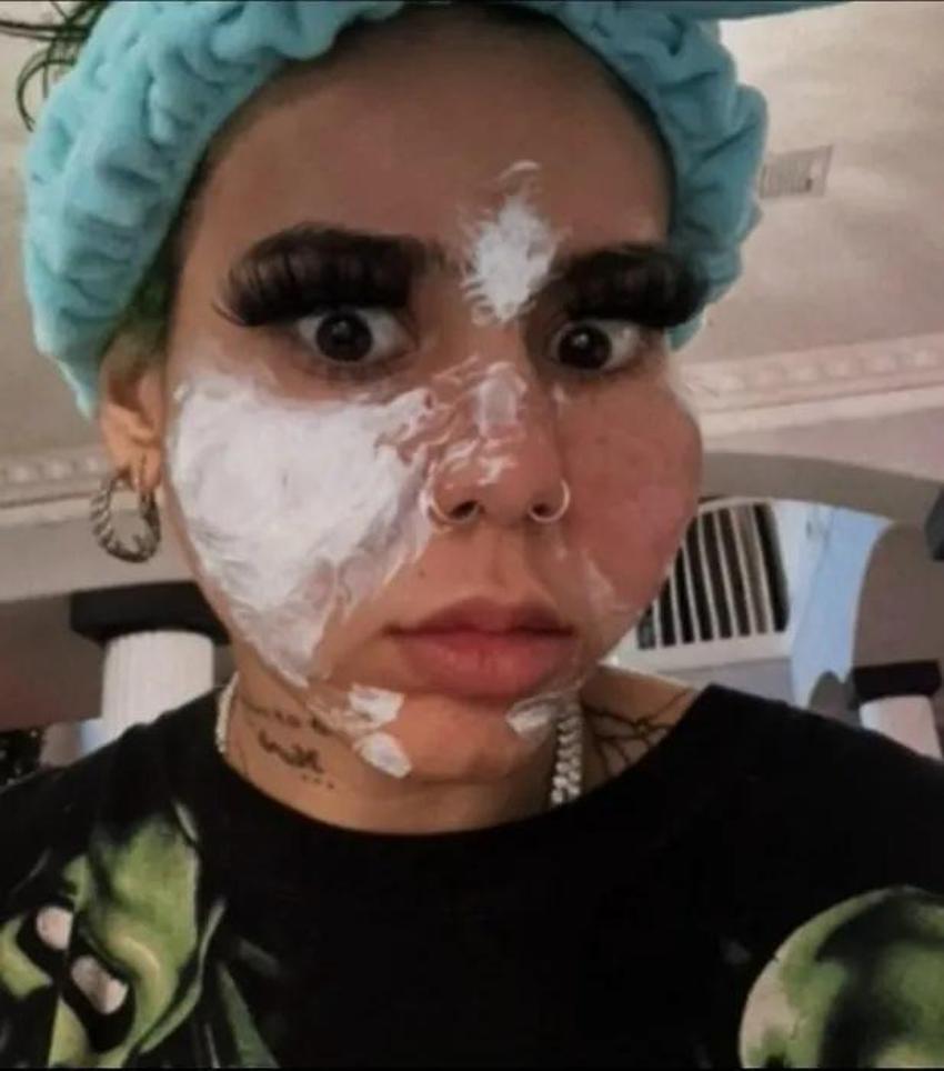 Evde yüz maskesi yaptı, yüzünü kaybetti! Bu ürünleri çöpe atın: Plastik cerrahlar kesin uyardı!