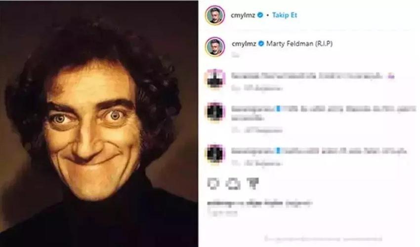 Marty Feldman fotoğrafı paylaşmıştı! Cem Yılmaz görme kaybı yaşadığını söyledi
