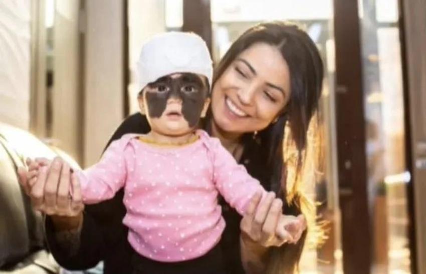 Yüzündeki leke yüzünden lanetli deniyordu! Küçük kızın şimdiki haline bir bakın!