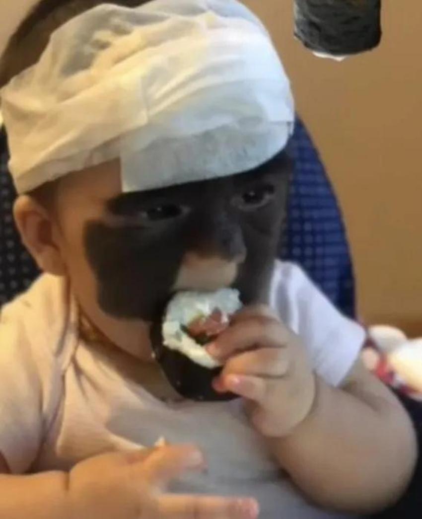 Yüzündeki leke yüzünden lanetli deniyordu! Küçük kızın şimdiki haline bir bakın!