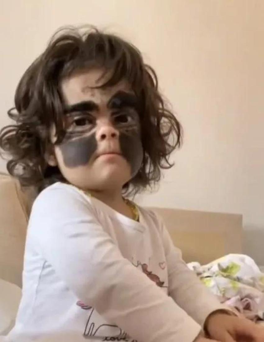 Yüzündeki leke yüzünden lanetli deniyordu! Küçük kızın şimdiki haline bir bakın!