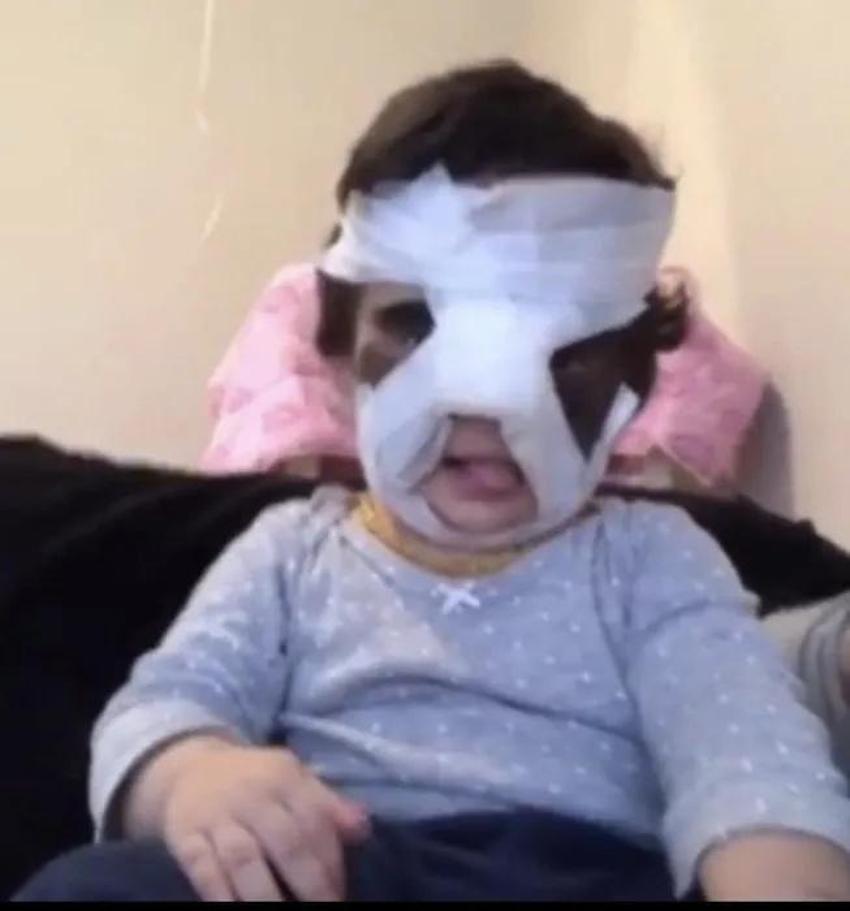 Yüzündeki leke yüzünden lanetli deniyordu! Küçük kızın şimdiki haline bir bakın!