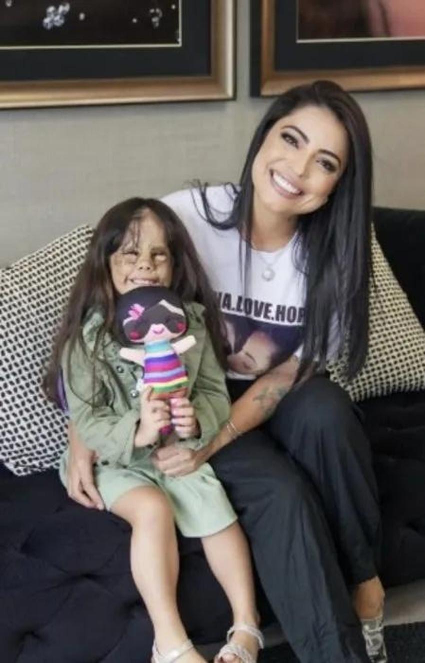 Yüzündeki leke yüzünden lanetli deniyordu! Küçük kızın şimdiki haline bir bakın!