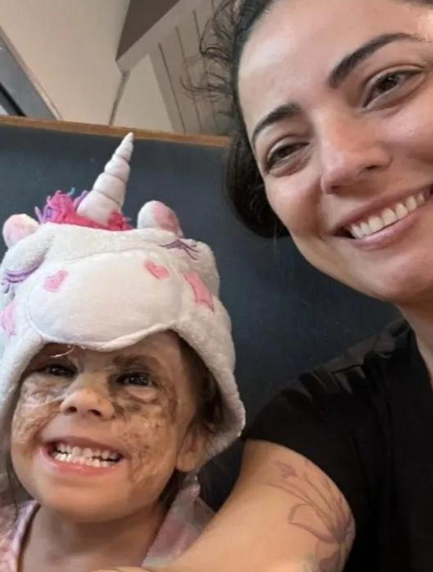 Yüzündeki leke yüzünden lanetli deniyordu! Küçük kızın şimdiki haline bir bakın!